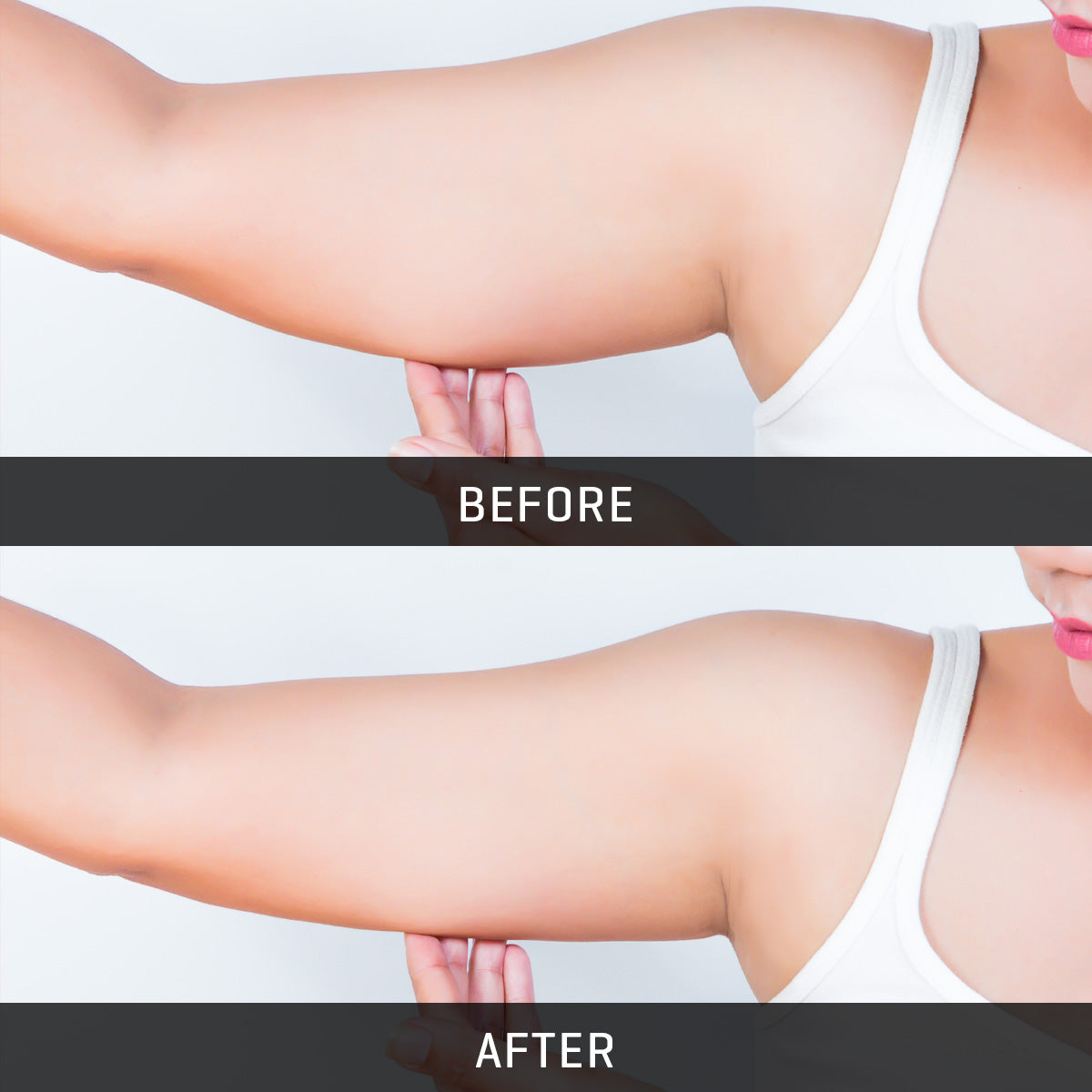 Underarm Muscle Toning Device with Adjustable Intensity