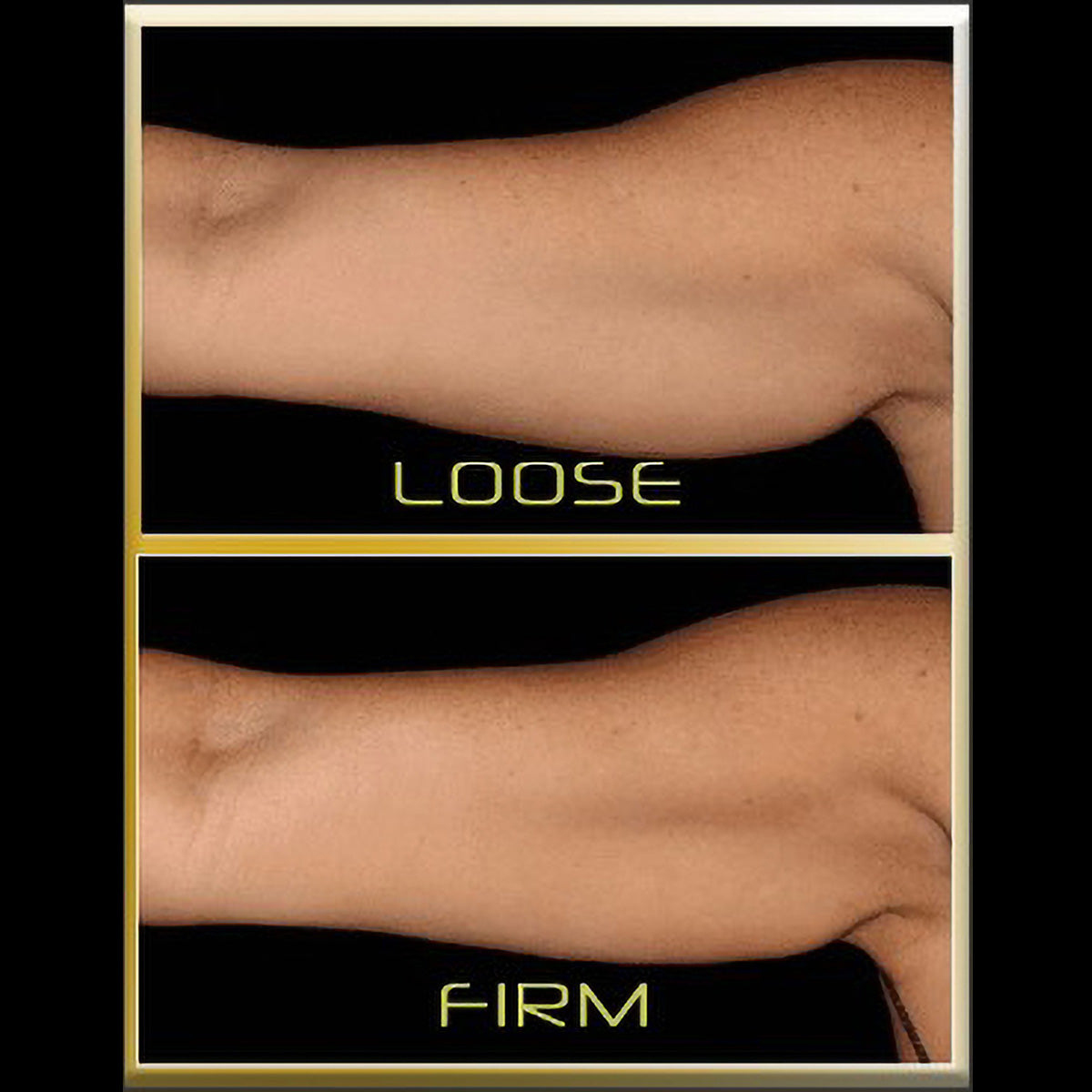 Underarm Muscle Toning Device with Adjustable Intensity